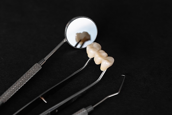 Dental Bridge San Juan Capistrano, CA