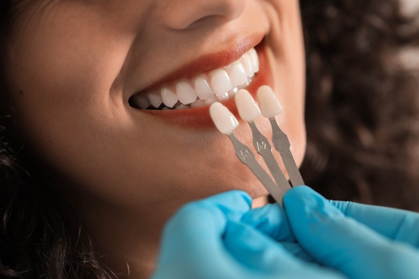 Dental Veneers San Juan Capistrano, CA
