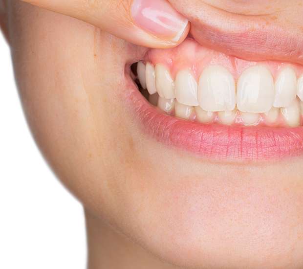 San Juan Capistrano Gum Disease