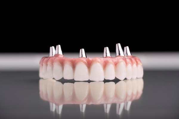 Implant Supported Dentures San Juan Capistrano, CA