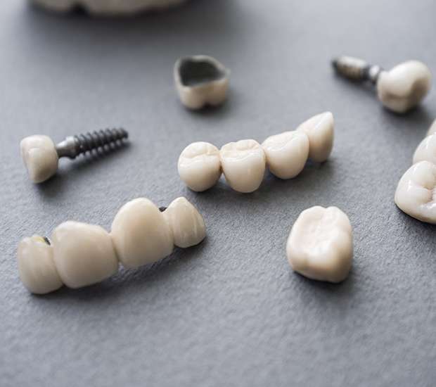 San Juan Capistrano The Difference Between Dental Implants and Mini Dental Implants