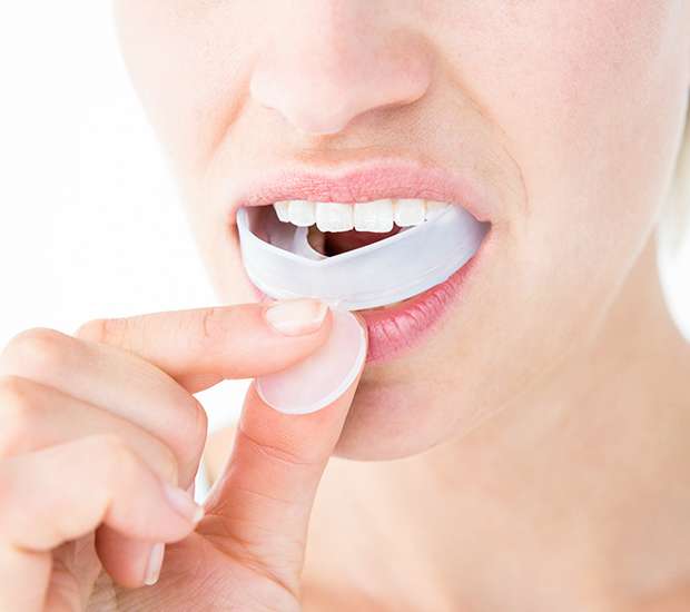 San Juan Capistrano Mouth Guards