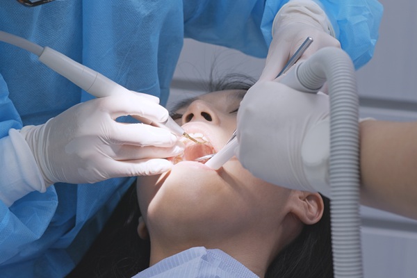 Do You Need a Deep Cleaning? Signs and Diagnosis
